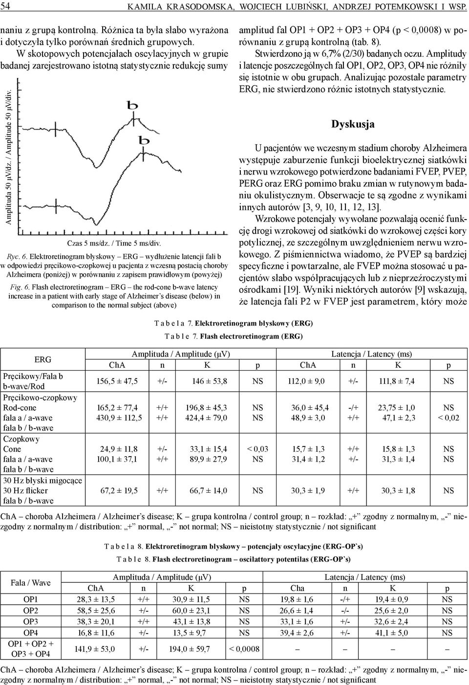 Elektroretinogram błyskowy ERG wydłużenie latencji fali b w odpowiedzi pręcikowoczopkowej u pacjenta z wczesną postacią choroby Alzheimera (poniżej) w porównaniu z zapisem prawidłowym (powyżej) Fig.