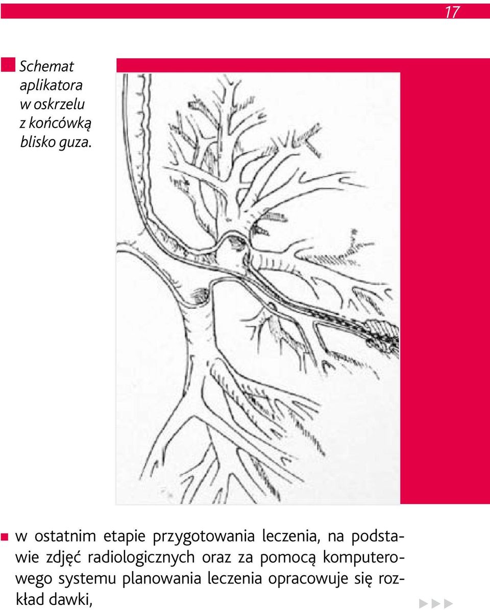 podstawie zdjęć radiologicznych oraz za pomocą