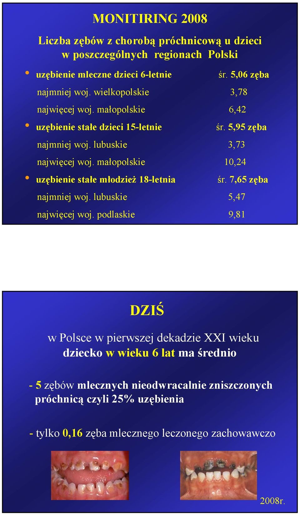 małopolskie 10,24 uzębienie stałemłodzież 18-letnia śr. 7,65 zęba najmniej woj. lubuskie 5,47 najwięcej woj.