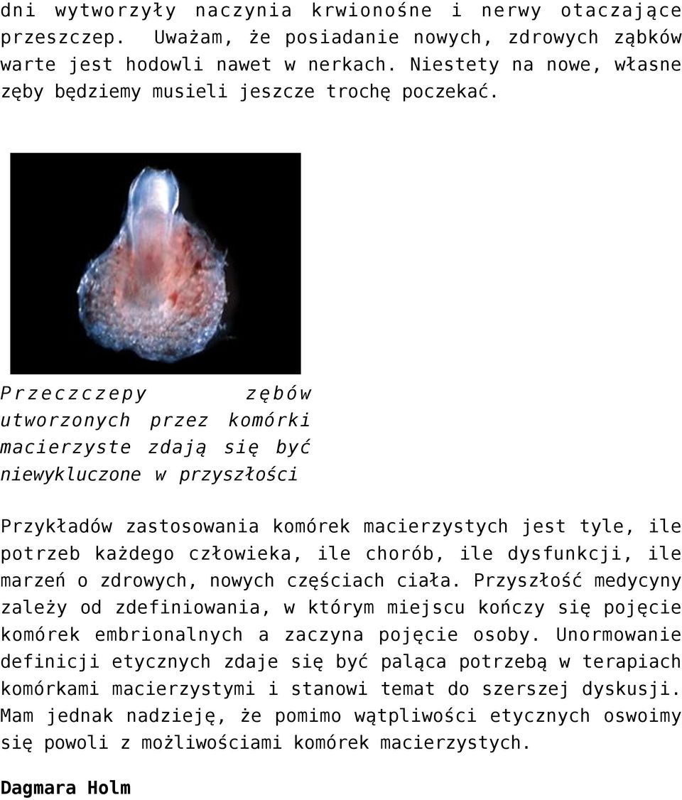 Przeczczepy zębów utworzonych przez komórki macierzyste zdają się być niewykluczone w przyszłości Przykładów zastosowania komórek macierzystych jest tyle, ile potrzeb każdego człowieka, ile chorób,