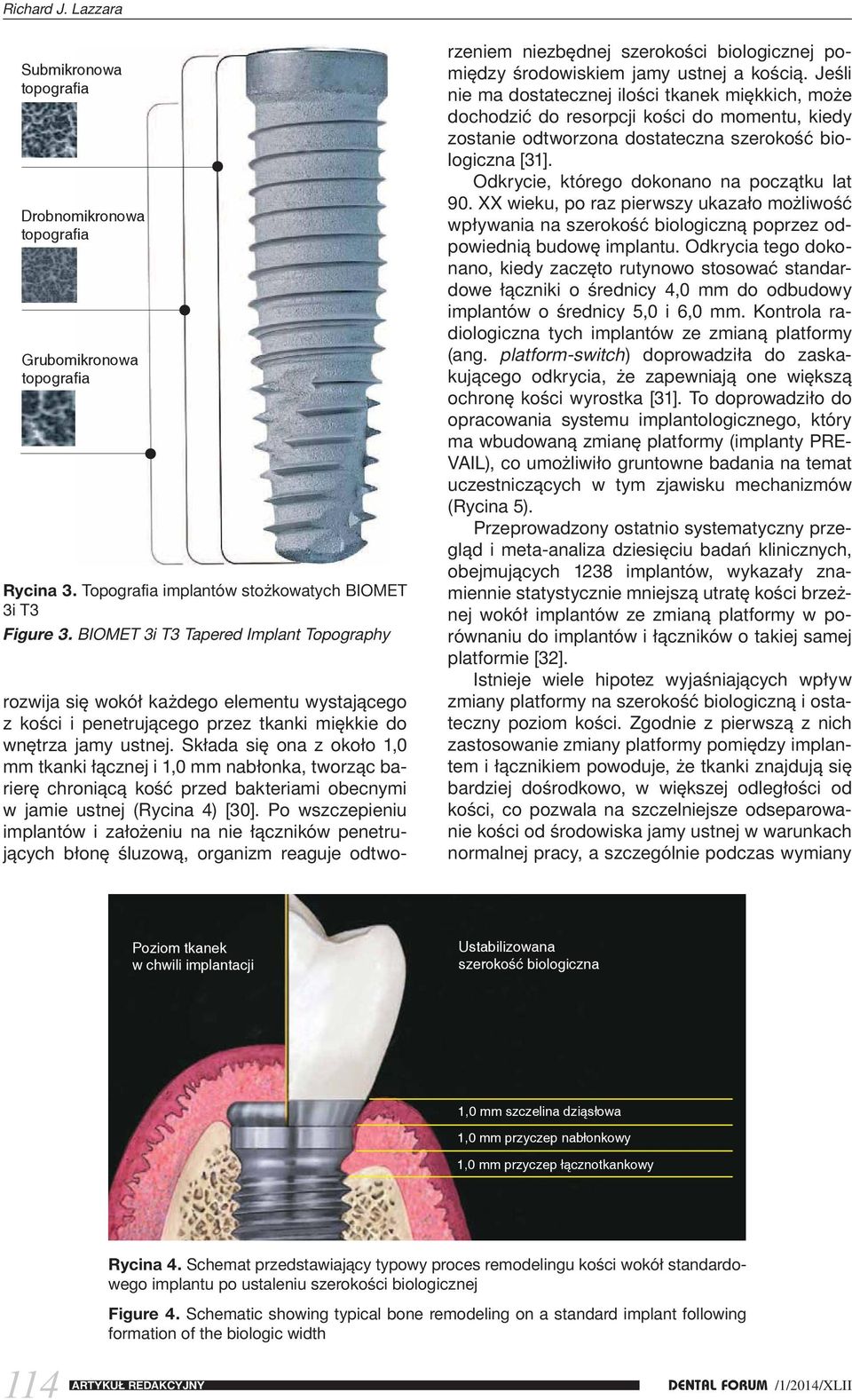 Składa się ona z około 1,0 mm tkanki łącznej i 1,0 mm nabłonka, tworząc barierę chroniącą kość przed bakteriami obecnymi w jamie ustnej (Rycina 4) [30].