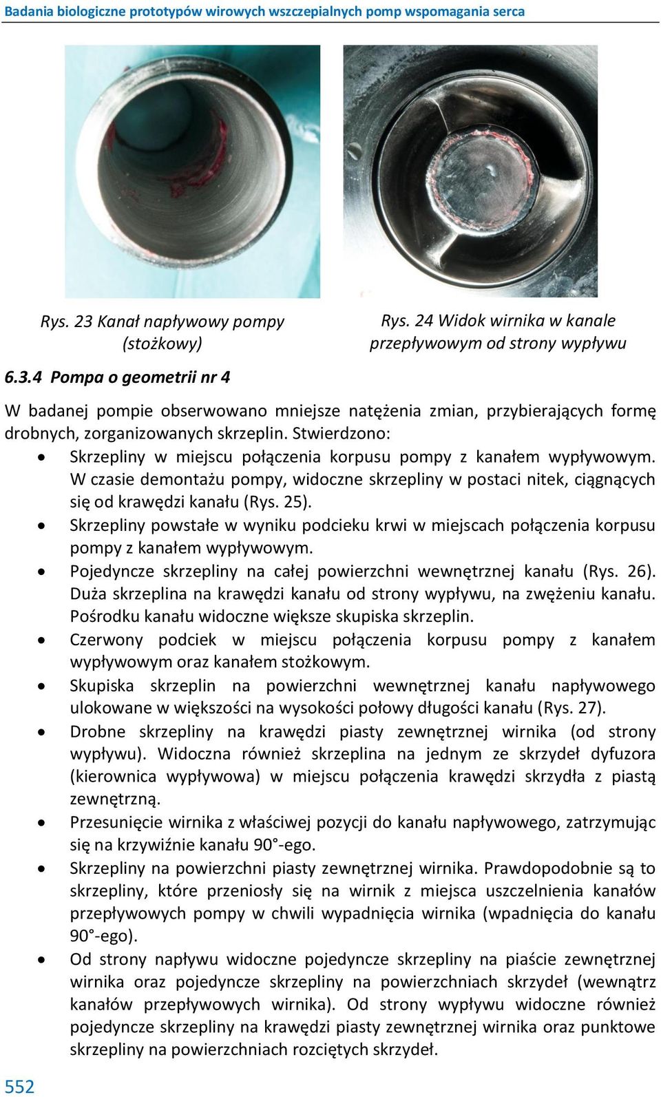 Stwierdzono: Skrzepliny w miejscu połączenia korpusu pompy z kanałem wypływowym. W czasie demontażu pompy, widoczne skrzepliny w postaci nitek, ciągnących się od krawędzi kanału (Rys. 25).