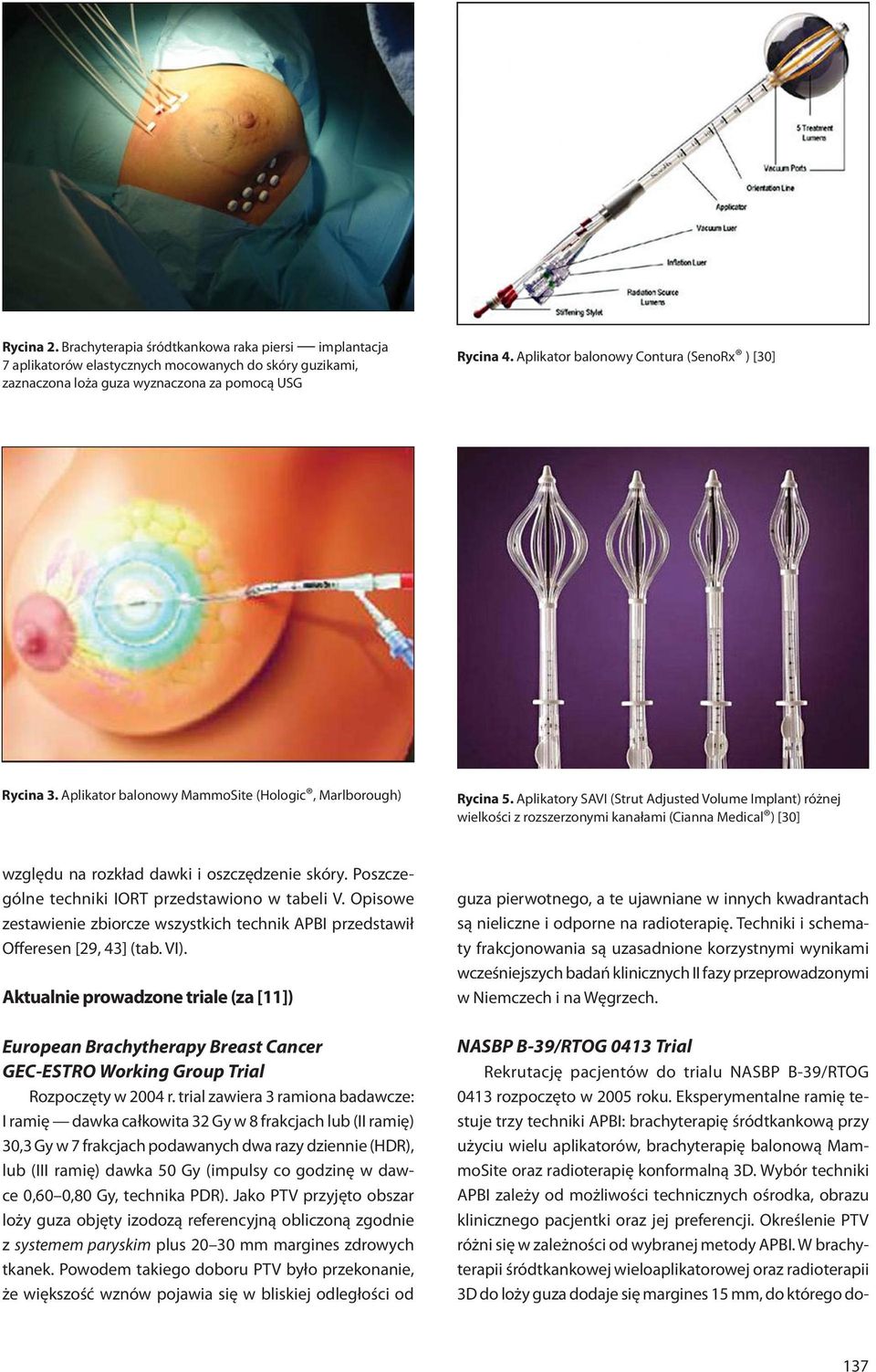 Aplikatory SAVI (Strut Adjusted Volume Implant) różnej wielkości z rozszerzonymi kanałami (Cianna Medical ) [30] względu na rozkład dawki i oszczędzenie skóry.