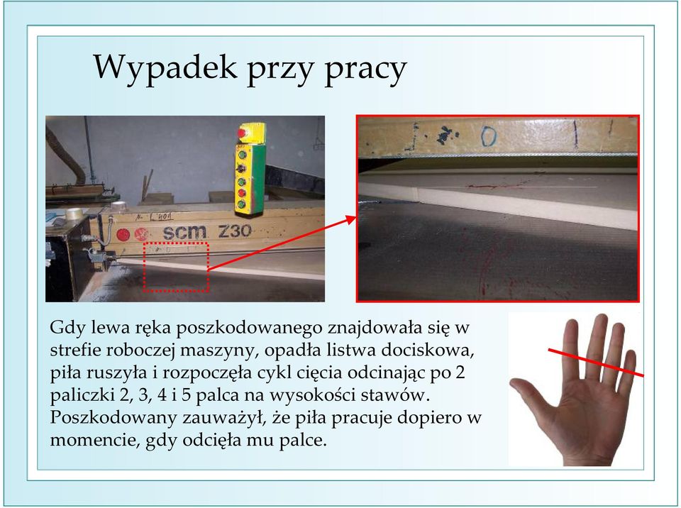 cięcia odcinając po 2 paliczki 2, 3, 4 i 5 palca na wysokości stawów.