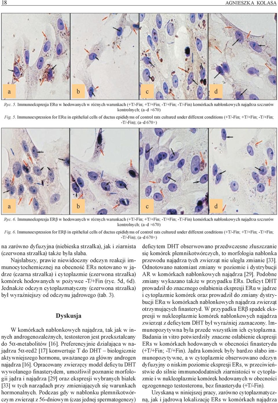 Immunoexpression for ERα in epithelial cells of ductus epididyms of control rats cultured under different conditions (+T/-Fin; +T/+Fin; -T/+Fin; -T/-Fin); (a d 67