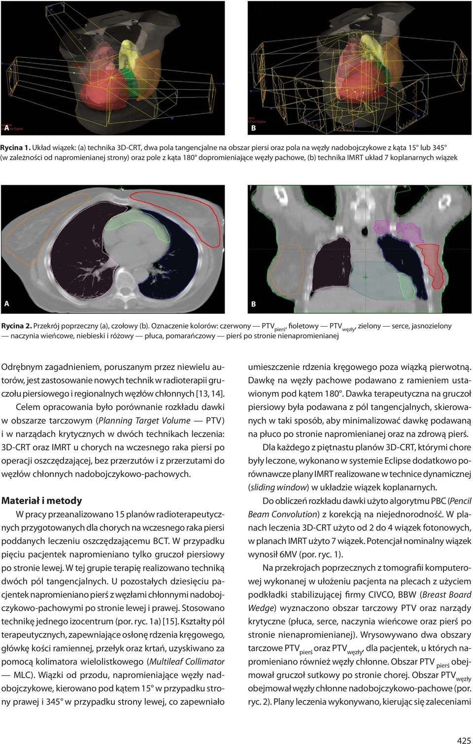 dopromieniające węzły pachowe, (b) technika IMRT układ 7 koplanarnych wiązek A B Rycina 2. Przekrój poprzeczny (a), czołowy (b).