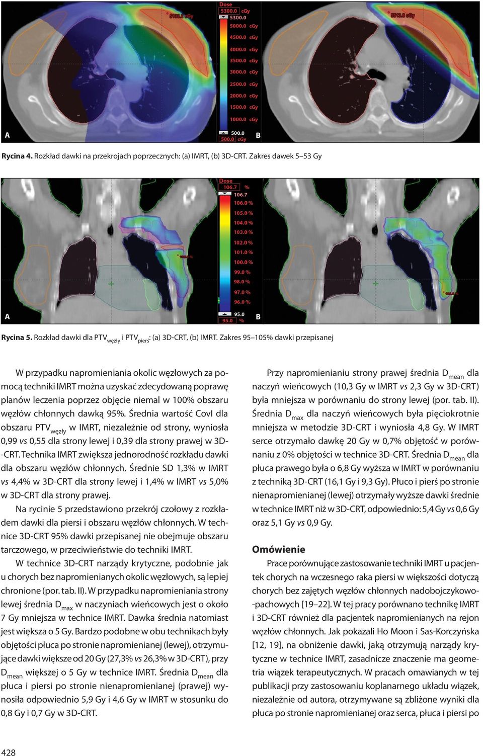 chłonnych dawką 95%. Średnia wartość CovI dla obszaru węzły w IMRT, niezależnie od strony, wyniosła vs 0,55 dla strony lewej i 0,39 dla strony prawej w 3D- -CRT.