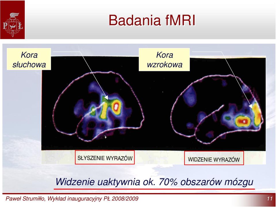 70% obszarów mózgu Paweł