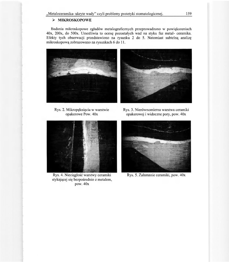 Umożliwia to ocenę pozostałych wad na styku faz metal- ceramika. Efekty tych obserwacji przedstawiono na rysunku 2 do 5.