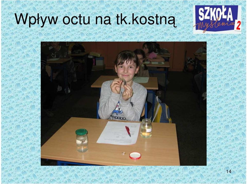 tk.kostną