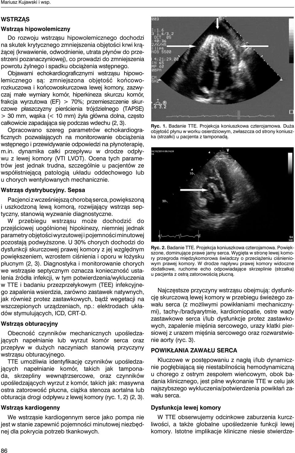 pozanaczyniowej), co prowadzi do zmniejszenia powrotu żylnego i spadku obcią żenia wstępnego.