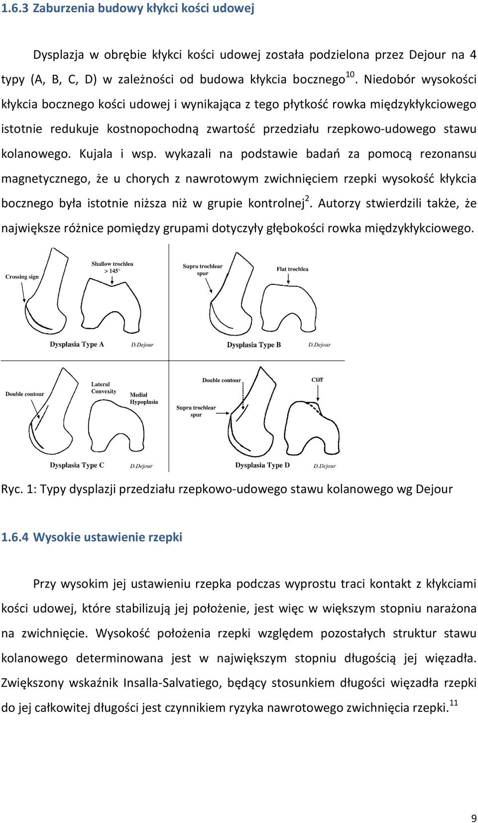 Kujala i wsp. wykazali na podstawie badań za pomocą rezonansu magnetycznego, że u chorych z nawrotowym zwichnięciem rzepki wysokość kłykcia bocznego była istotnie niższa niż w grupie kontrolnej 2.