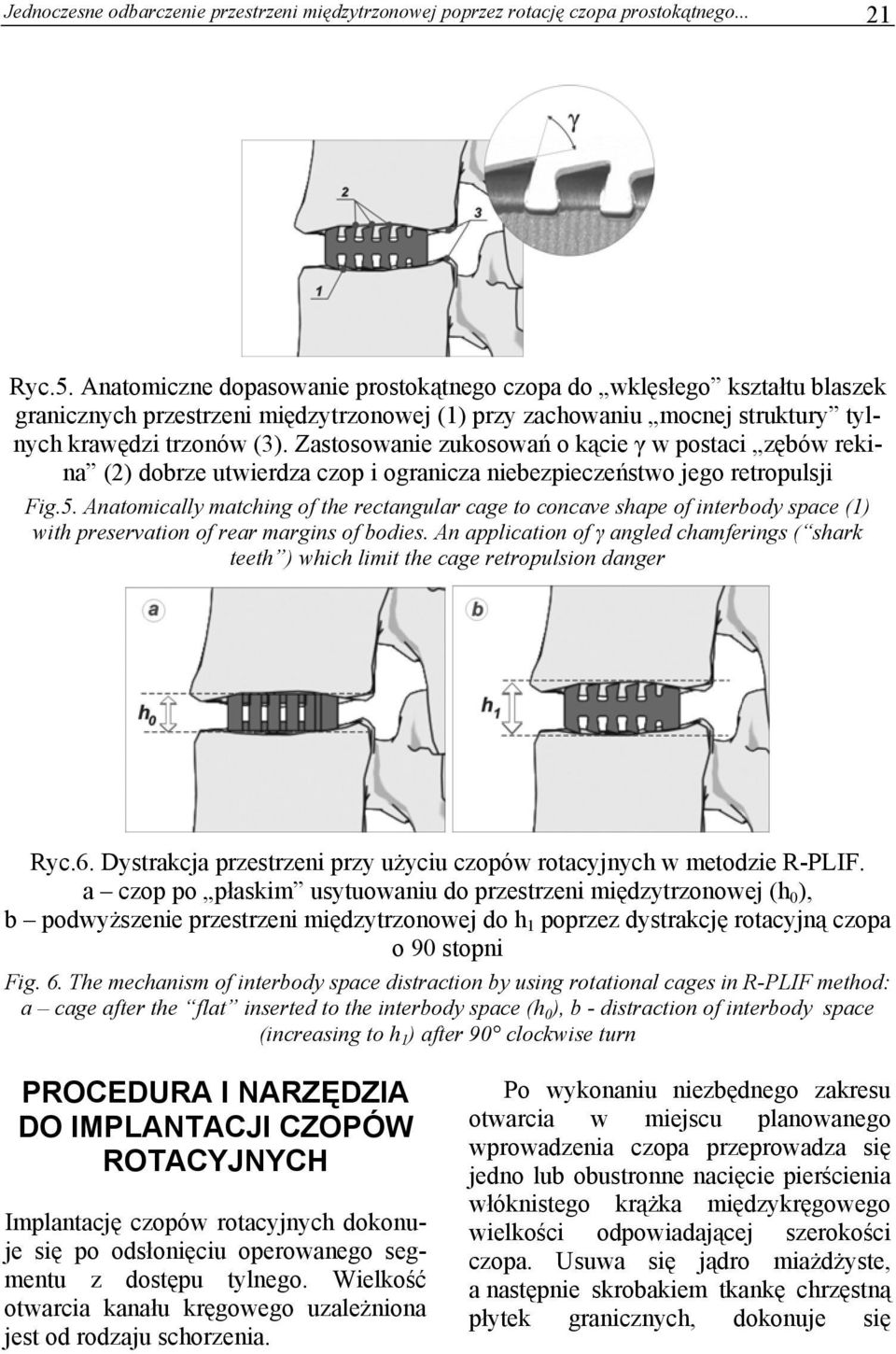 Zastosowanie zukosowań o kącie γ w postaci zębów rekina (2) dobrze utwierdza czop i ogranicza niebezpieczeństwo jego retropulsji Fig.5.