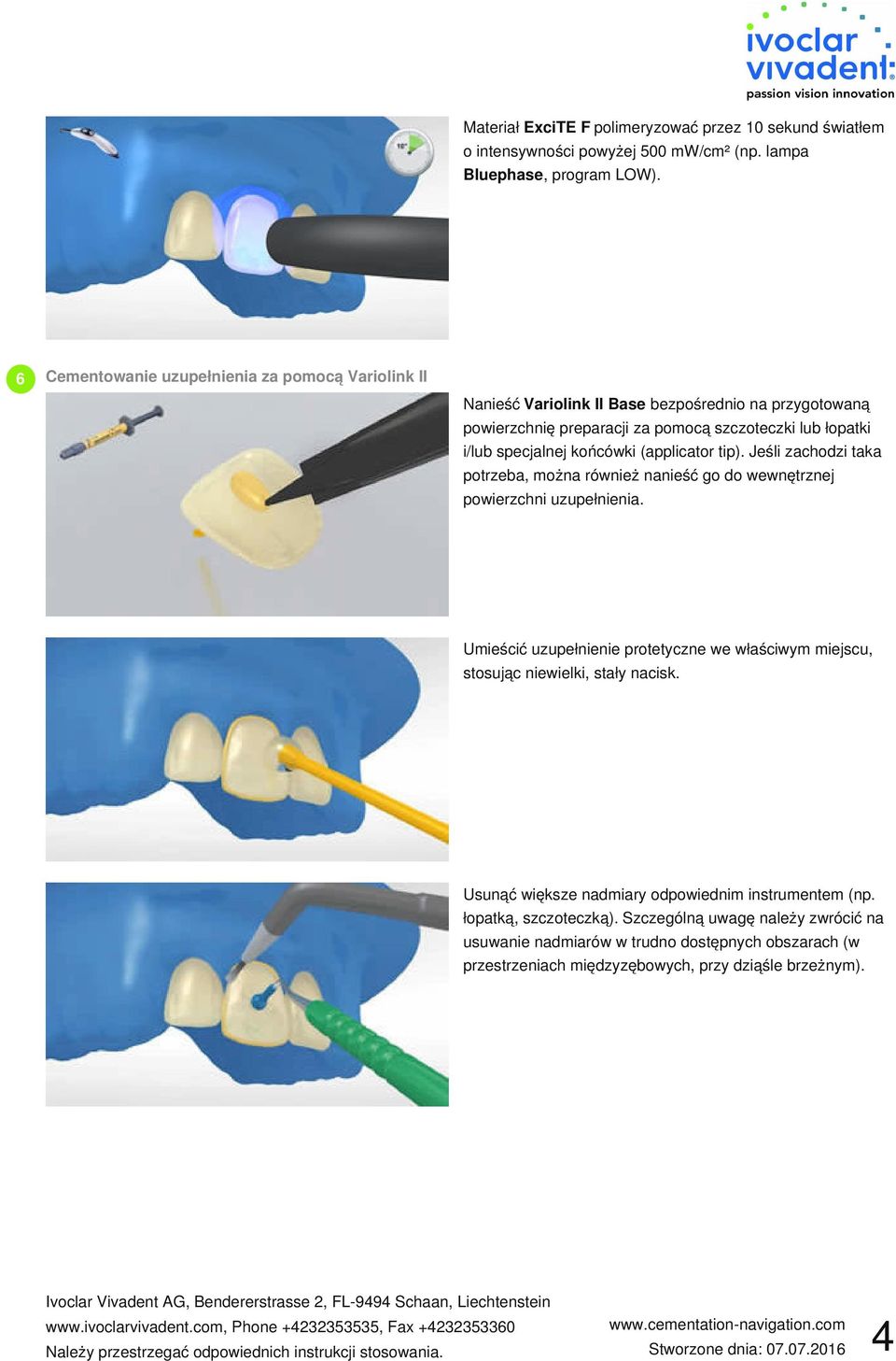 (applicator tip). Jeśli zachodzi taka potrzeba, można również nanieść go do wewnętrznej powierzchni uzupełnienia.