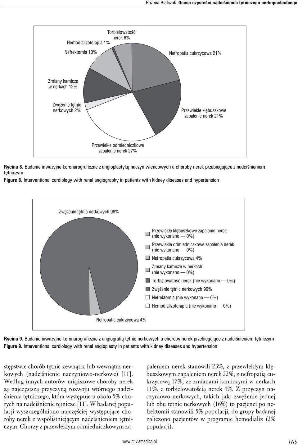 Interventional cardiology with renal angiography in patients with kidney diseases and hypertension Rycina 9.