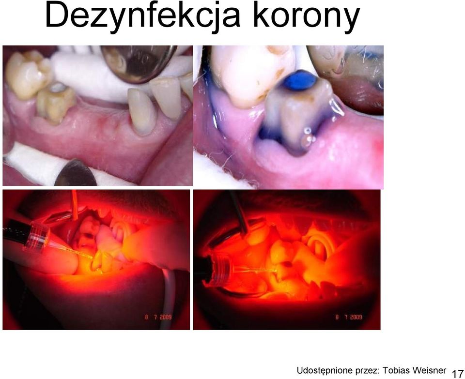 Udostępnione