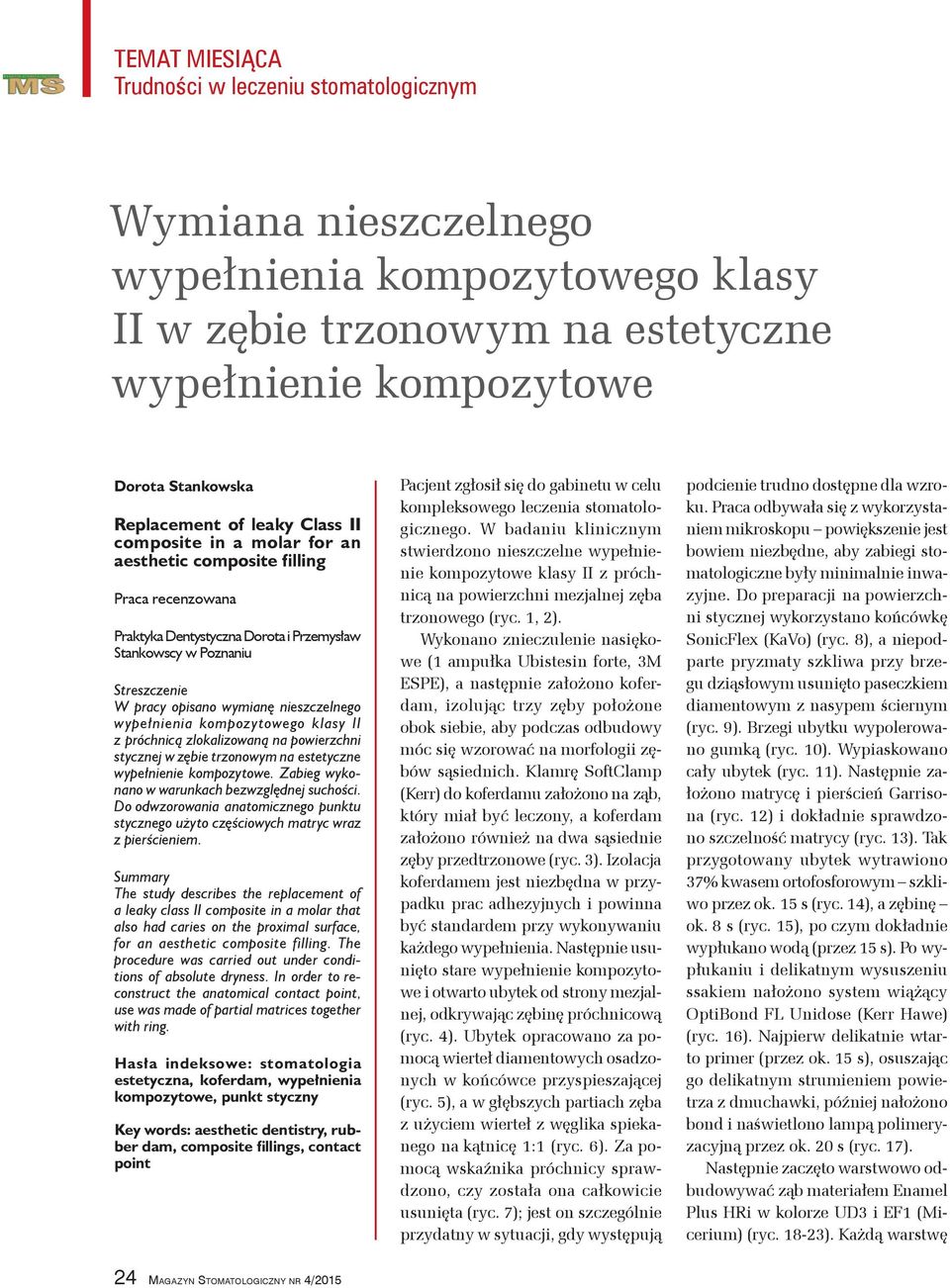 nieszczelnego wypełnienia kompozytowego klasy II z próchnicą zlokalizowaną na powierzchni stycznej w ze bie trzonowym na estetyczne wypełnienie kompozytowe.