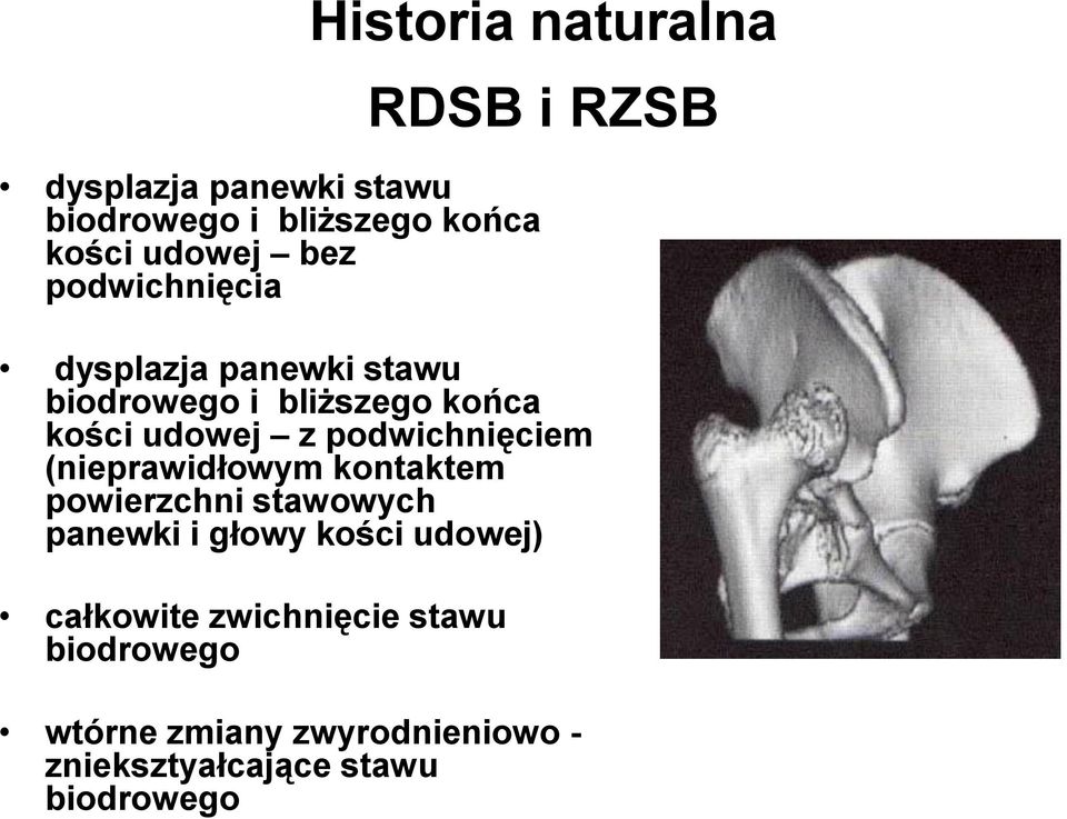 podwichnięciem (nieprawidłowym kontaktem powierzchni stawowych panewki i głowy kości udowej)