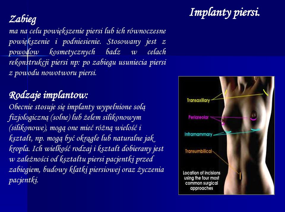 Rodzaje implantow: Obecnie stosuje się implanty wypełnione solą fizjologiczną (solne) lub żelem silikonowym (silikonowe), mogą one mieć różną wielość