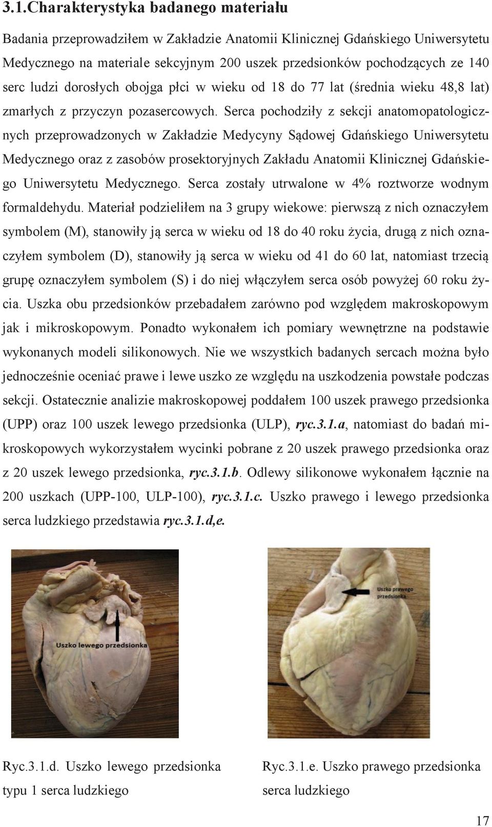 Serca pochodziły z sekcji anatomopatologicznych przeprowadzonych w Zakładzie Medycyny Sądowej Gdańskiego Uniwersytetu Medycznego oraz z zasobów prosektoryjnych Zakładu Anatomii Klinicznej Gdańskiego