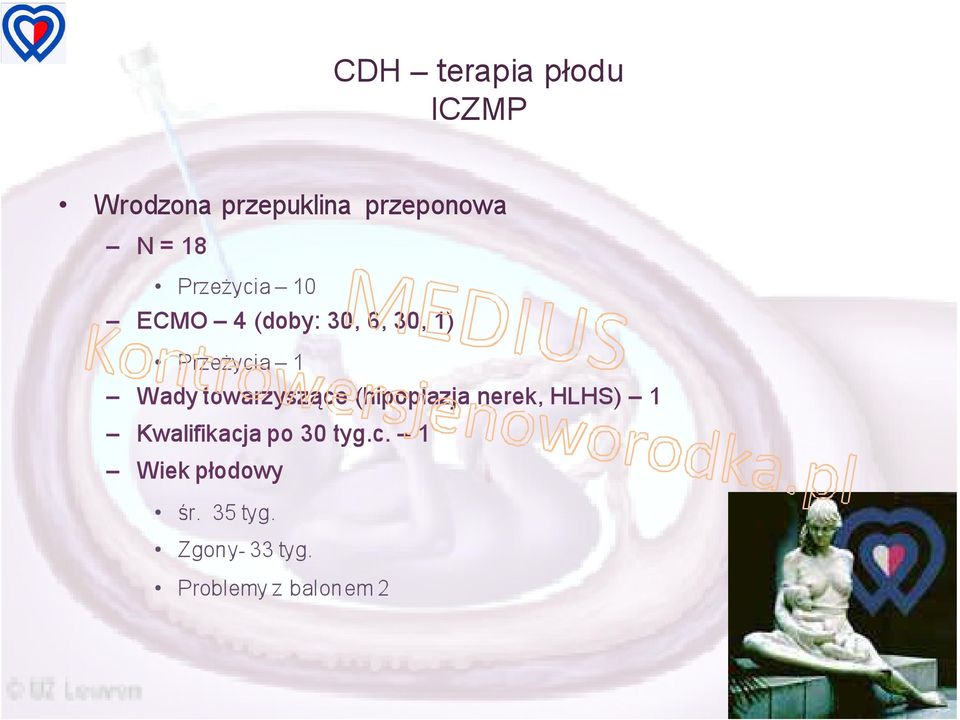 towarzyszące (hipoplazja nerek, HLHS) 1 Kwalifikacja po 30 tyg.