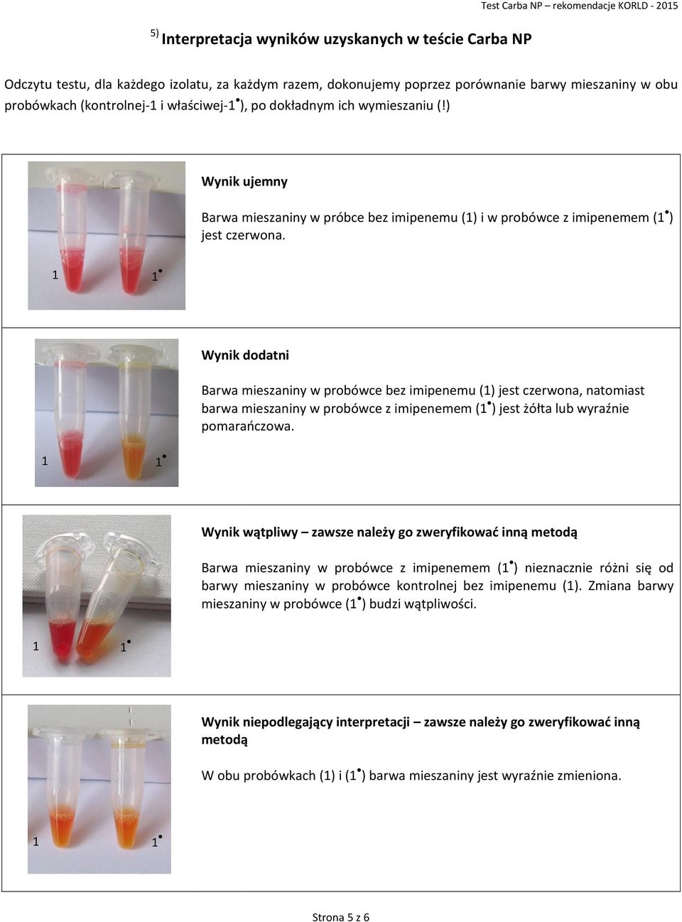 1 1 Wynik dodatni Barwa mieszaniny w probówce bez imipenemu (1) jest czerwona, natomiast barwa mieszaniny w probówce z imipenemem (1 ) jest żółta lub wyraźnie pomarańczowa.