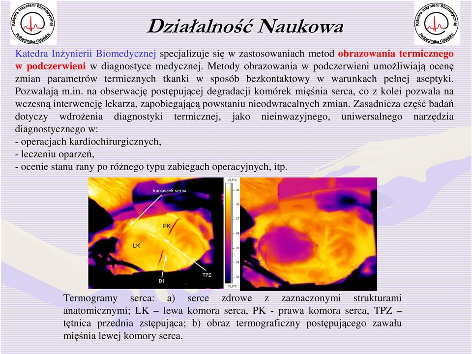 na obserwację postępującej degradacji komórek mięśnia serca, co z kolei pozwala na wczesną interwencję lekarza, zapobiegającą powstaniu nieodwracalnych zmian.