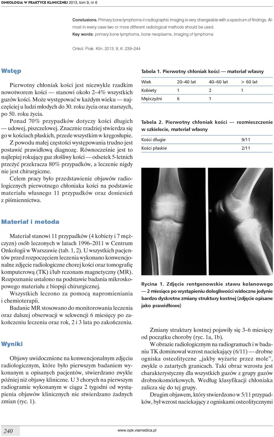 2013; 9, 6: 239 244 Wstęp Pierwotny chłoniak kości jest niezwykle rzadkim nowotworem kości stanowi około 2 4% wszystkich guzów kości. Może występować w każdym wieku najczęściej u ludzi młodych do 30.