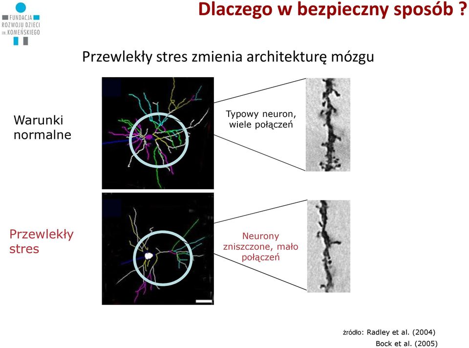 normalne Typowy neuron, wiele połączeń Przewlekły