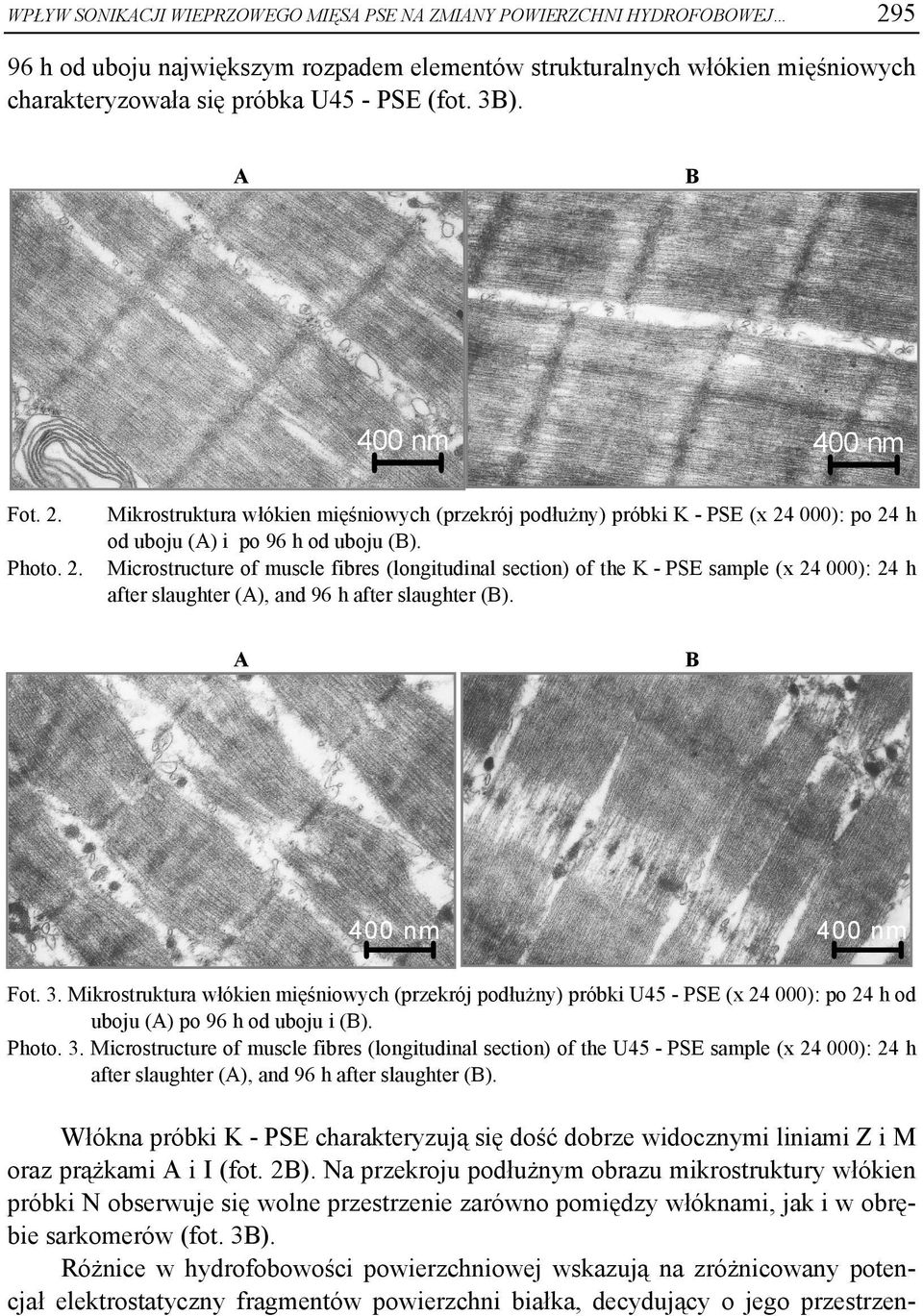 Microstructure of muscle fibres (longitudinal section) of the K - PSE sample (x 24 000): 24 h after slaughter (A), and 96 h after slaughter (B). A B Fot. 3.