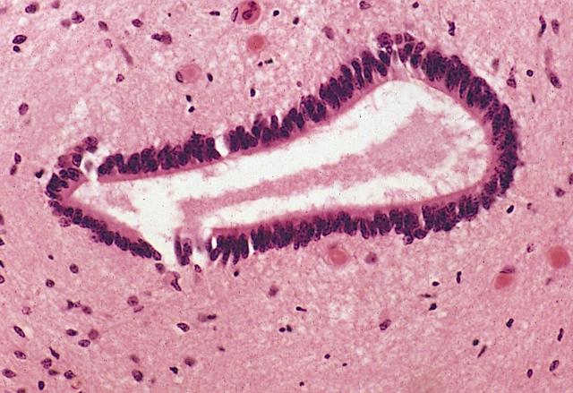 Ependymoycty Pochodzenie neuroektoderma (pierwotna cewa nerwowa) Komórki kształtu