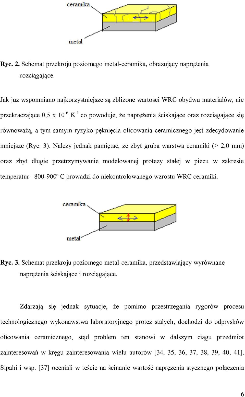 ryzyko pęknięcia olicowania ceramicznego jest zdecydowanie mniejsze (Ryc. 3).