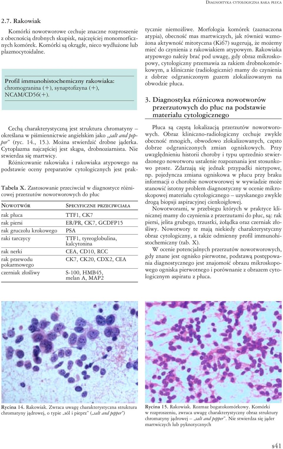 Zastosowanie przeciwciał w diagnostyce różnicowej przerzutów nowotworowych do płuc NOWOTWÓR rak płuca rak piersi rak gruczołu krokowego raki tarczycy rak nerki rak przewodu pokarmowego czerniak