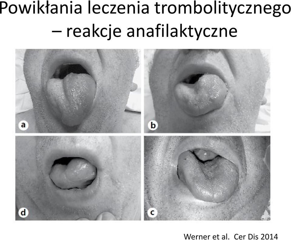 reakcje