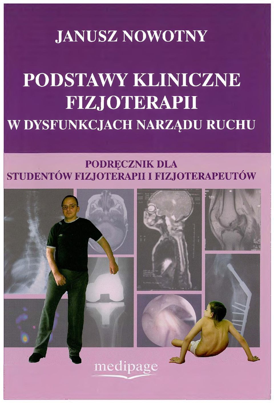 DYSFUNKCJACH NARZĄDU RUCHU