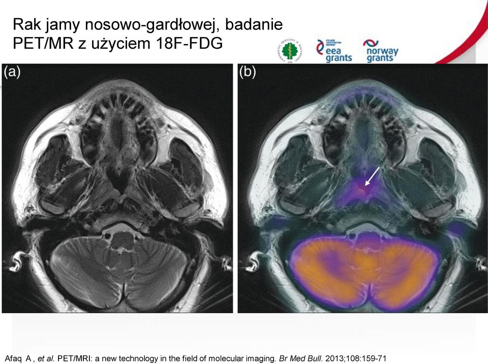 PET/MRI: a new technology in the field