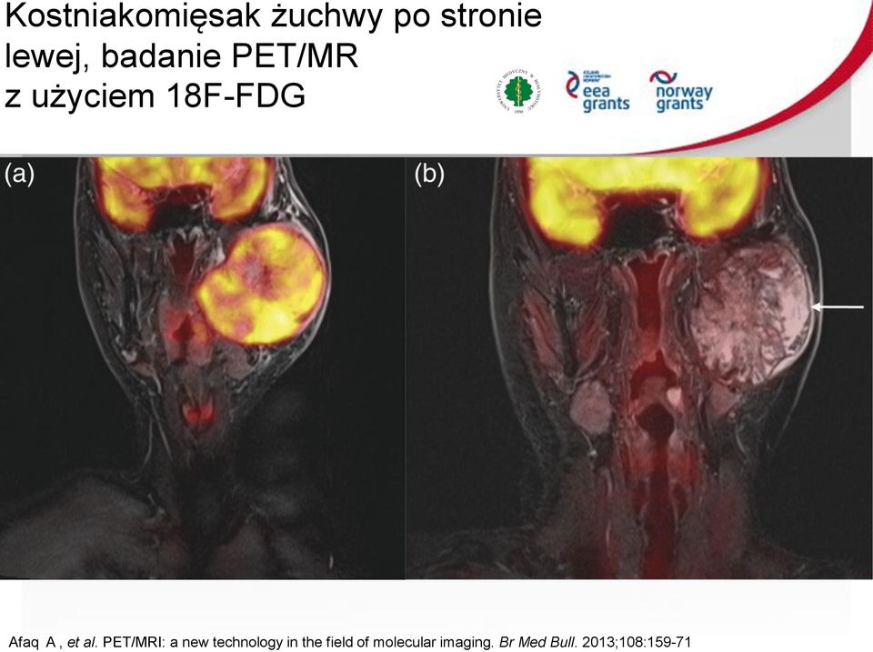 al. PET/MRI: a new technology in the field