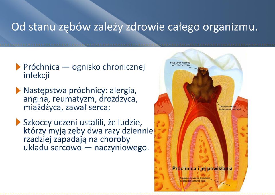 angina, reumatyzm, drożdżyca, miażdżyca, zawał serca; Szkoccy uczeni