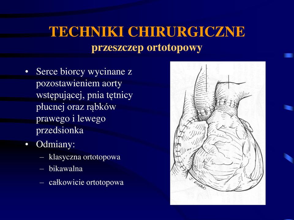 tętnicy płucnej oraz rąbków prawego i lewego przedsionka