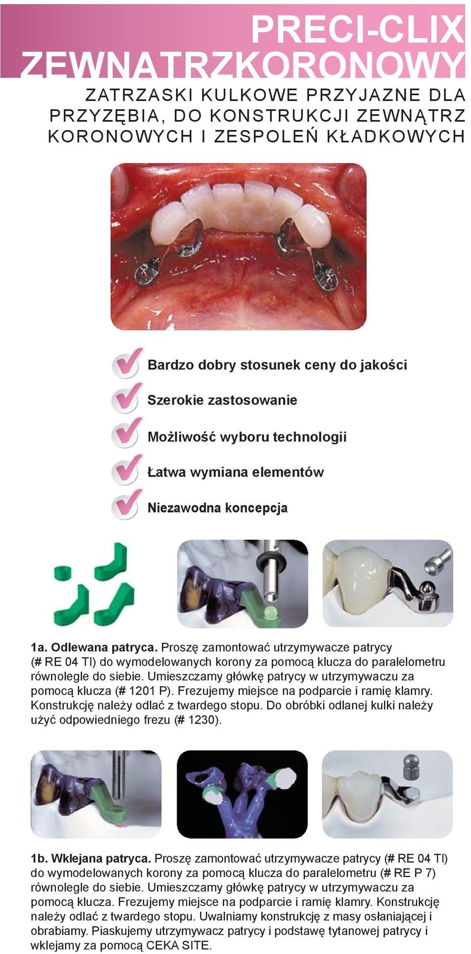 Proszę zamontować utrzymywacze patrycy (# RE 04 TI) do wymodelowanych korony za pomocą klucza do paralelometru równolegle do siebie.