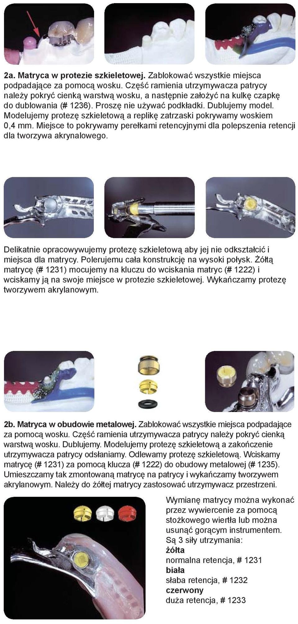 Modelujemy protezę szkieletową a replikę zatrzaski pokrywamy woskiem 0,4 mm. Miejsce to pokrywamy perełkami retencyjnymi dla polepszenia retencji dla tworzywa akrynalowego.