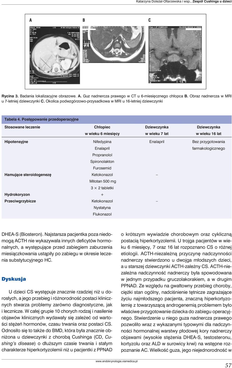 Postępowanie przedoperacyjne Stosowane leczenie Chłopiec Dziewczynka Dziewczynka w wieku 6 miesięcy w wieku 7 lat w wieku 16 lat Hipotensyjne Nifedypina Enalapril Bez przygotowania Enalapril