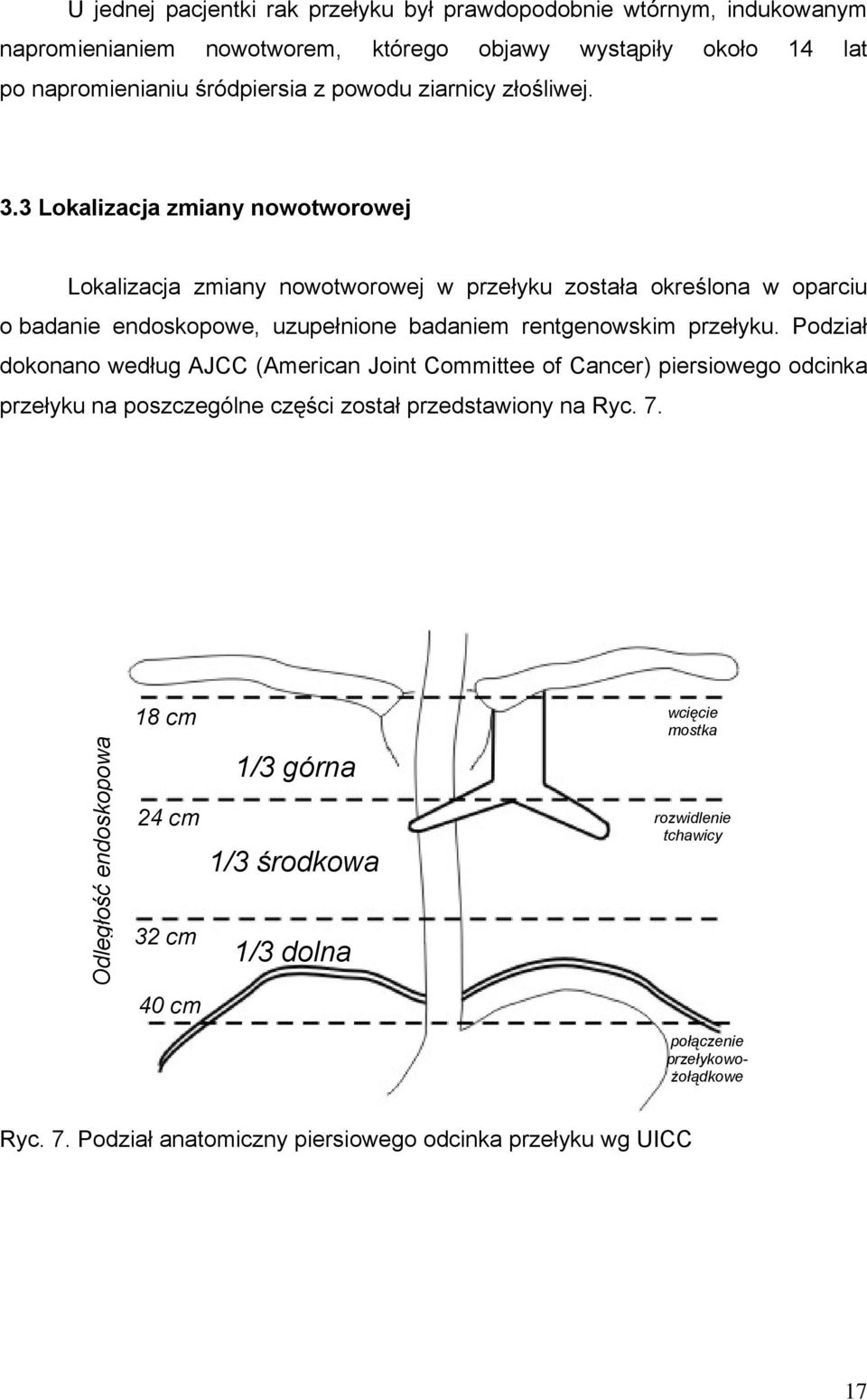 3 Lokalizacja zmiany nowotworowej Lokalizacja zmiany nowotworowej w przełyku została określona w oparciu o badanie endoskopowe, uzupełnione badaniem rentgenowskim przełyku.