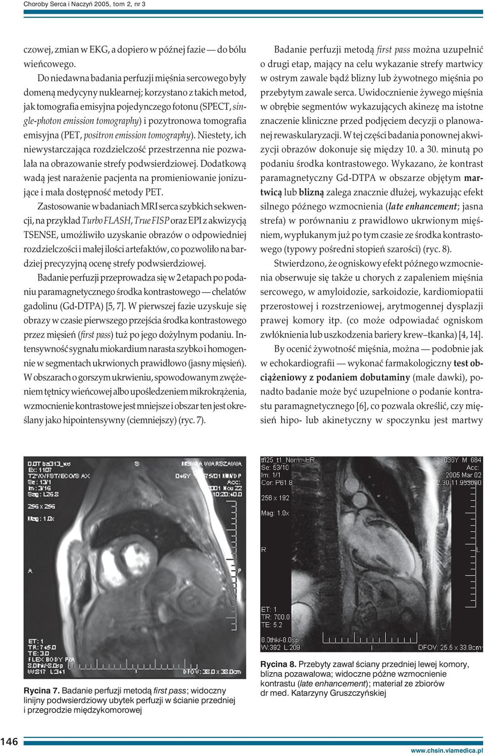 pozytronowa tomografia emisyjna (PET, positron emission tomography). Niestety, ich niewystarczająca rozdzielczość przestrzenna nie pozwalała na obrazowanie strefy podwsierdziowej.