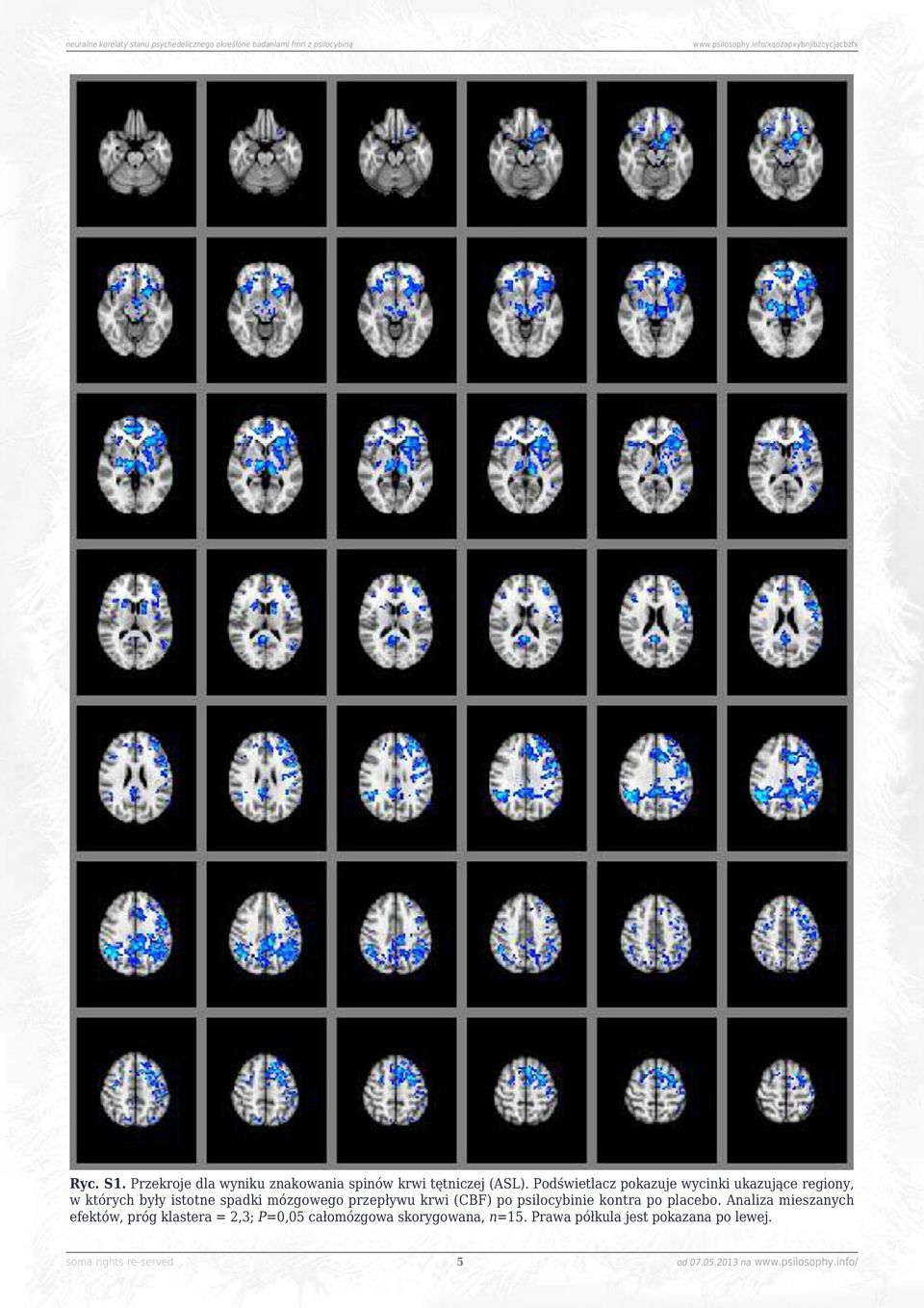 mózgowego przepływu krwi (CBF) po psilocybinie kontra po placebo.