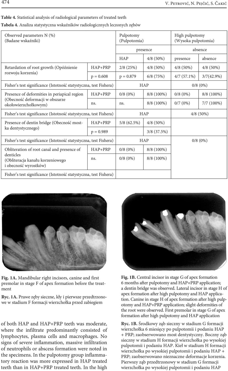 presence absence Retardation of root growth (Opóźnienie rozwoju korzenia) HAP+PRP 2/8 (25%) 4/8 (50%) 4/8 (50%) 4/8 (50%) p = 0.608 p = 0.879 6/8 (75%) 4/7 (57.1%) 3/7(42.