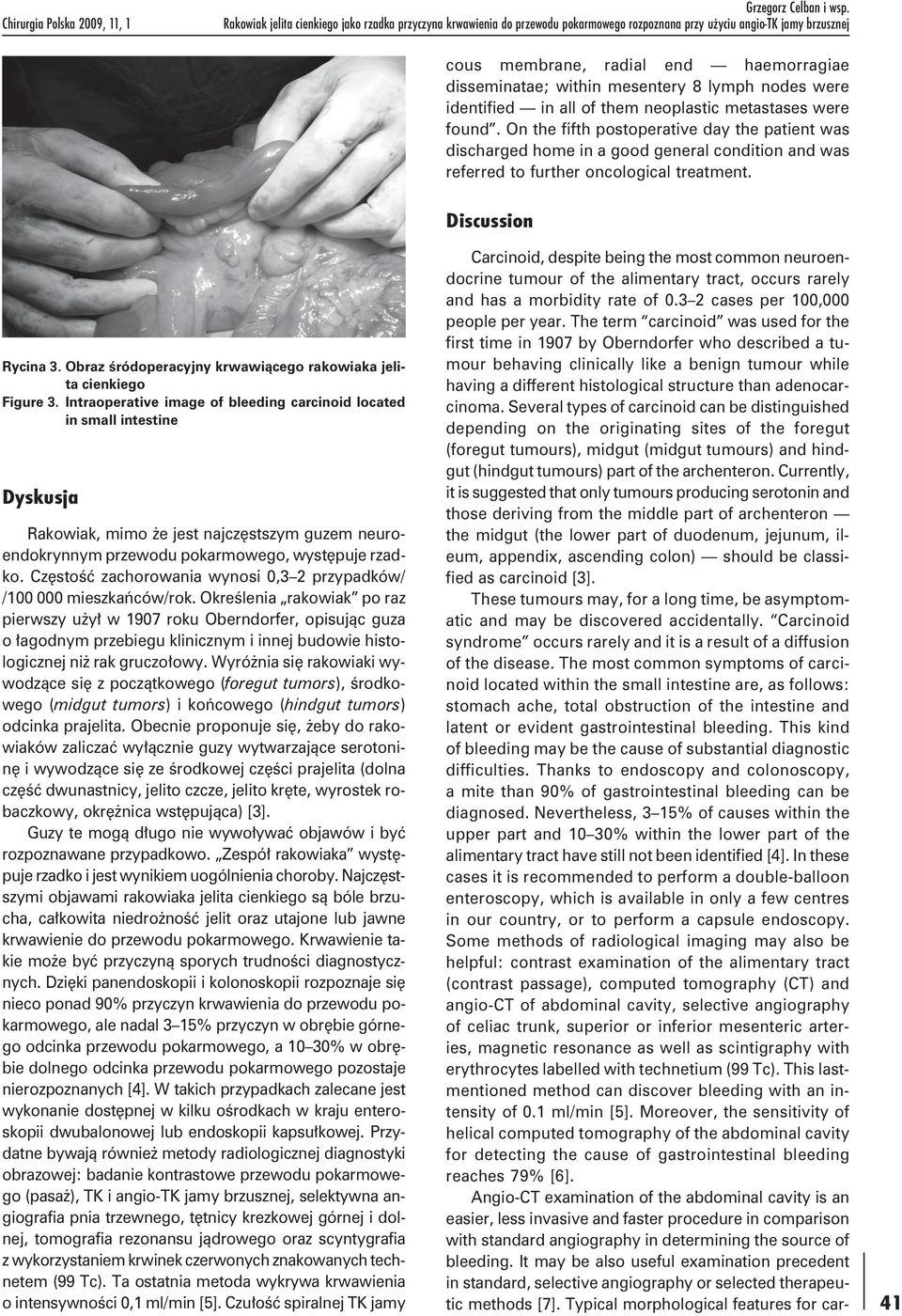 8 lymph nodes were identified in all of them neoplastic metastases were found.