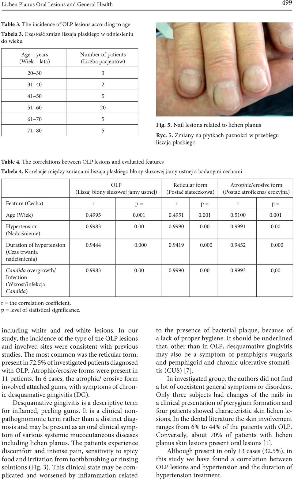 5. Zmiany na płytkach paznokci w przebiegu liszaja płaskiego Table 4. The correlations between OLP lesions and evaluated features Tabela 4.