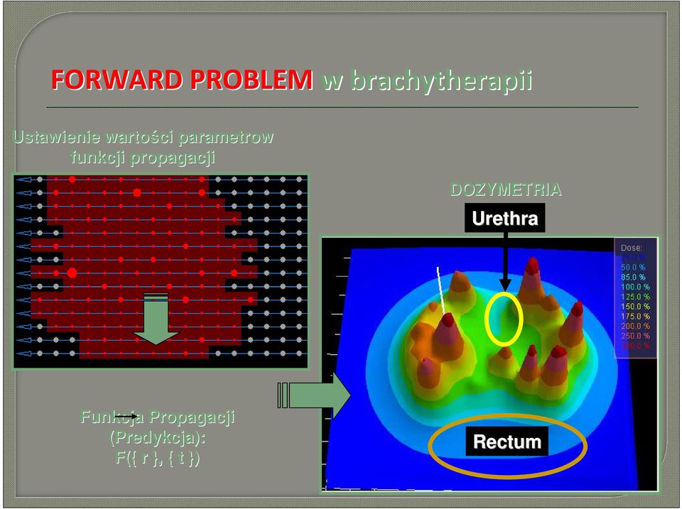 propagacji DOZYMETRIA Urethra Funkcja
