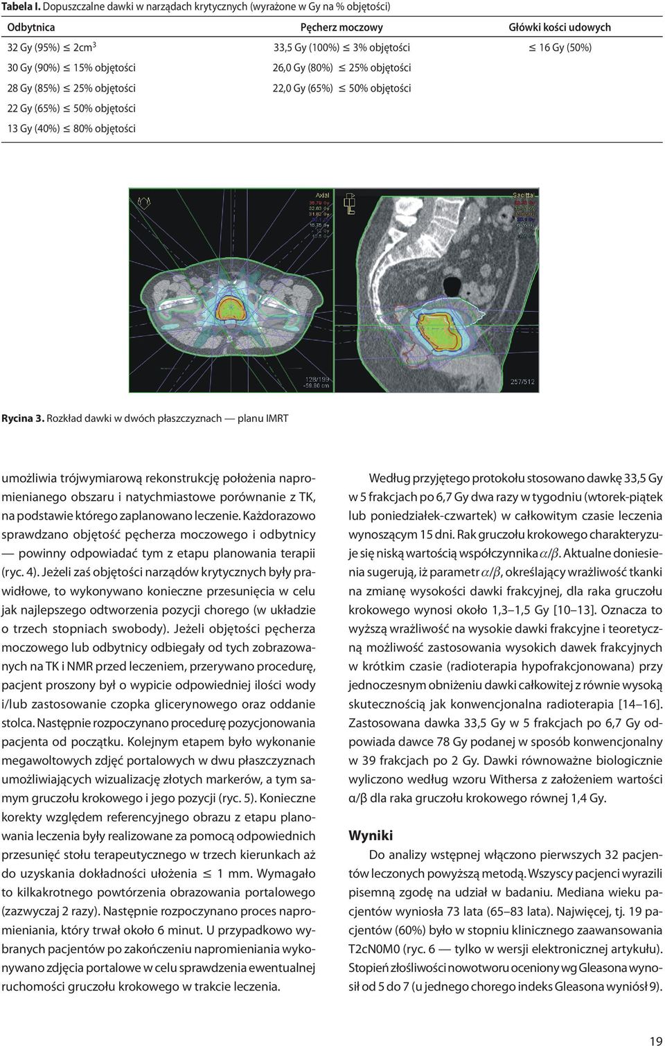 objętości 26,0 Gy (80%) 25% objętości 28 Gy (85%) 25% objętości 22,0 Gy (65%) 50% objętości 22 Gy (65%) 50% objętości 13 Gy (40%) 80% objętości Rycina 3.